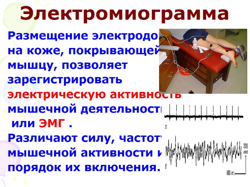 Электромиограмма Размещение электродов  на коже, покрывающей  мышцу, позволяет  зарегистрировать  электрическую